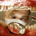 The Importance of Regular Dental Visits for Preventing Tooth Decay