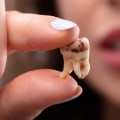 The Impact of Poor Oral Health During Pregnancy on Children's Dental Health