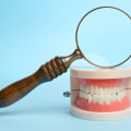 Expert Tips for Preventing and Reversing Tooth Decay