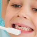 Expert Tips for Preventing Tooth Decay in Children
