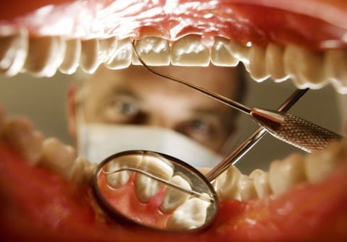 The Importance of Regular Dental Visits for Preventing Tooth Decay
