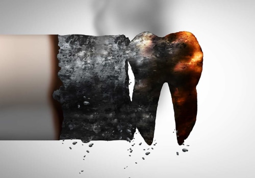 The Impact of Smoking on Oral Health