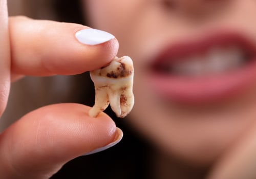 The Impact of Poor Oral Health During Pregnancy on Children's Dental Health