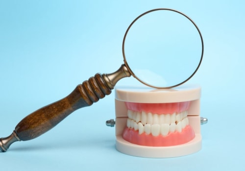 Expert Tips for Preventing and Reversing Tooth Decay
