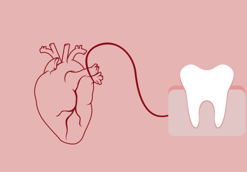 The Surprising Connection Between Heart Disease and Tooth Decay
